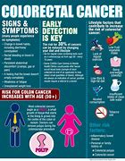 Image result for Colon Cancer Symptoms in Men Signs