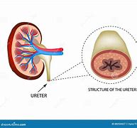 Image result for Foto Ureter