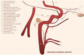 Image result for Middle Meningeal Arteryt