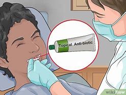 Image result for How to Avoid Plaque On Teeth