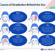 Image result for Headache Left Side of Head