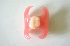 Image result for Valplast Partial One Tooth