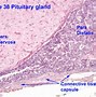 Image result for Parafollicular Cells Histology