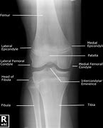 Image result for Normal Knee Skin