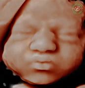 Image result for 5D Scanner Baby