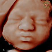 Image result for Baby Scan 3D 4D