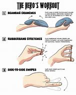 Image result for Dislocated Finger Joint