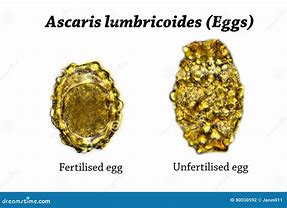 Image result for Ascaris Larvae