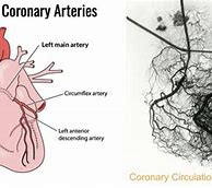 Image result for Coronary Artery Angiography