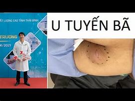 Image result for Cyst On Frenchie Bum