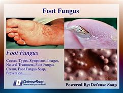 Image result for Fungus Soap