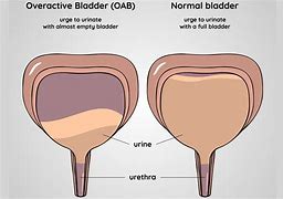 Image result for Normal Bladder