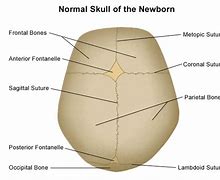 Image result for Midline Suture