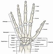 Image result for Capitate Bone Fracture