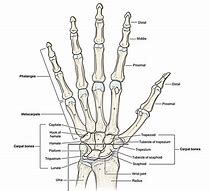 Image result for Capitate Bone Pain