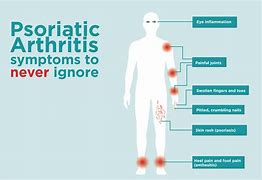 Image result for Psoriatic Arthritis On Face