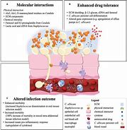 Image result for Candida Throat Infection