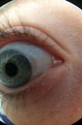 Image result for Prespective Eye Fish