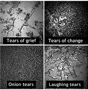 Image result for Happy vs Sad Tears Under a Microscope