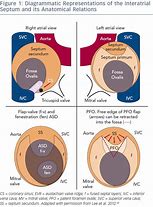 Image result for Interatrial Septum Anatomy