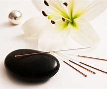 Image result for Acupuncture