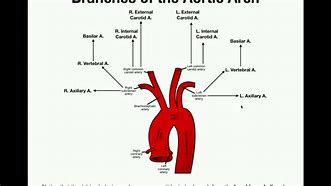 Image result for Aortic Vessels