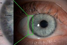 Image result for Limbus Cornea