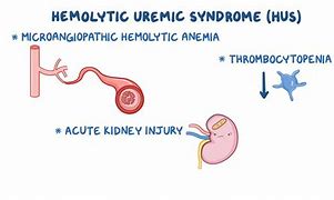 Image result for Uremic Anemia