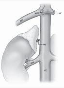 Image result for Adrenal Artery