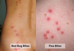 Image result for One Flea Bite