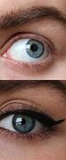 Image result for Person with No EyeLashes