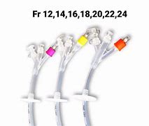 Image result for PEG Tube Replacement