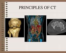 Image result for CT Scan Image for PPT