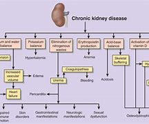 Image result for Chronic Kidney Disease