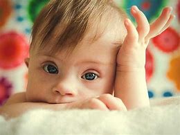 Image result for Down Syndrome Baby Pictures