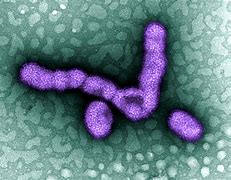 Image result for H1N1 Invade