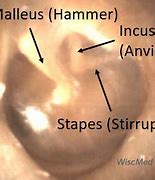 Image result for Ear Structure Hammer Stirrup Anvil