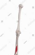 Image result for Extensor Pollicis Long Sensor Pinch