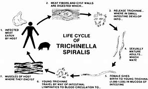 Image result for Trichinosis Parasite