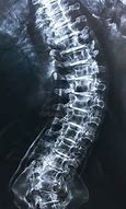 Image result for Human Spine Black and White