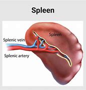 Image result for Spleen Disease Symptoms