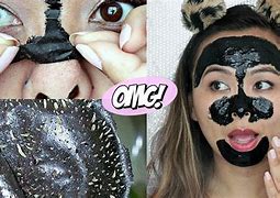 Image result for Skin Peels Blackhead Removal