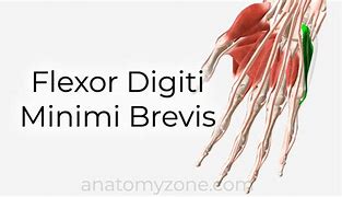 Image result for M Flexor Digiti Minimi Brevis