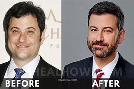 Image result for Jimmy Kimmel Before and After