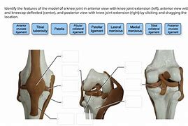 Image result for Left Knee