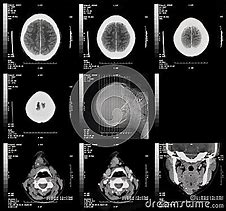 Image result for CT Scan Views