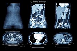 Image result for CT Scan Views