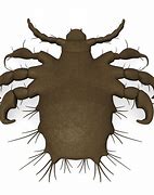 Image result for What Does Crabs Look Like On Skin