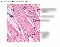 Image result for Cardiac Muscle Bundles