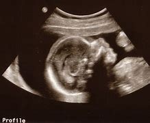 Image result for Baby Ultrasound Technician